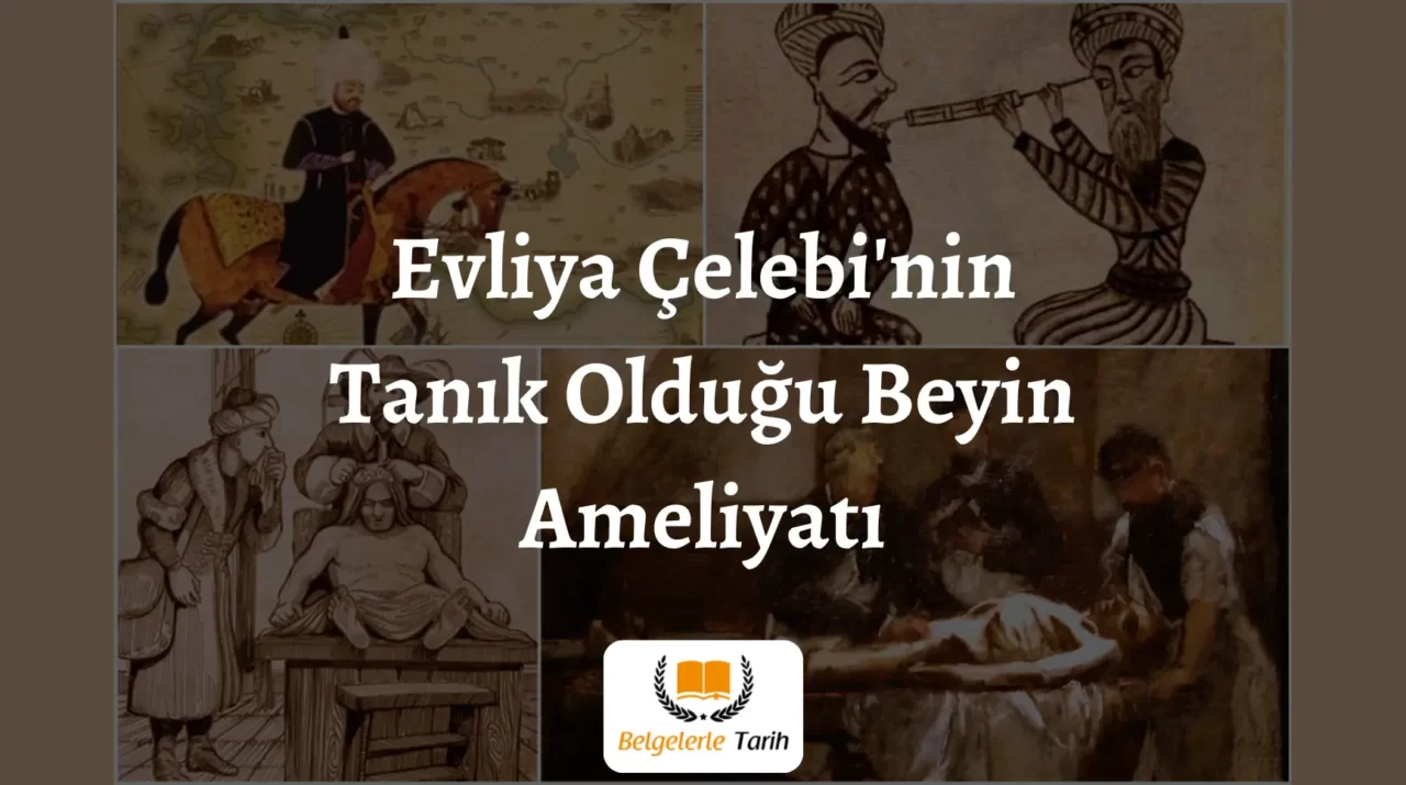 Evliya-Celebinin-Tanik-Oldugu-Beyin-Ameliyati