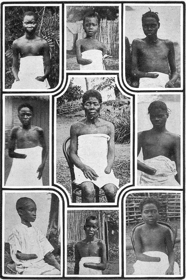 Belçika’nın Kongo Katliamları: Tarihin Kara Lekesi